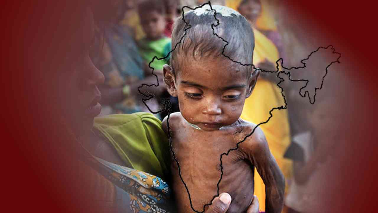 ঘটনা ও প্রবণতা : দেশে ৩৩ লাখ শিশু অপুষ্ট